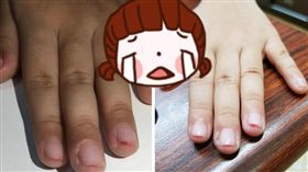 老園長,女兒,剪指甲,10指,虐待,幼兒園,女童,抓傷,私刑,酷刑（圖／翻攝自爆料公社）
