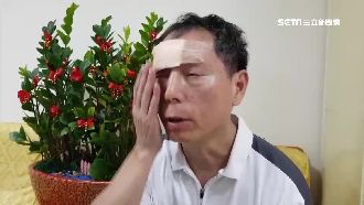 網怒了！視障「台灣阿甘」撞柱血狂噴