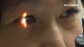 雷射筆燒.眼1200