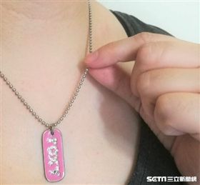 ▲34歲的何先生，多年前曾被項鍊刮傷胸口，傷口癒合後逐漸出現暗紅色腫塊，近期因癢痛難耐就醫檢查竟是蟹足腫作怪。（示意圖非新聞當事人／記者楊晴雯攝）