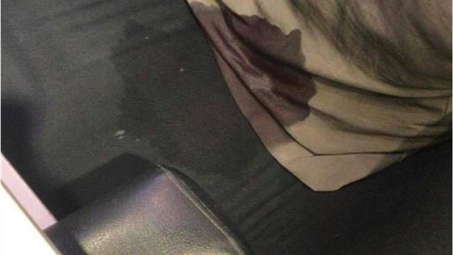 沙發驚見一灘血…真相讓人超想吐！