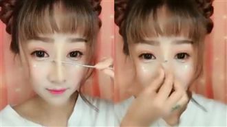 女神「鐵棒拆鼻」變大媽　網友全嚇傻