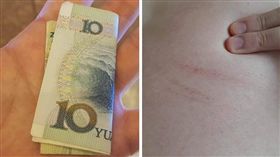  王樹偉,睡覺,鬼壓床,阿飄,女鬼,撿錢,出國,大腿,抓痕,撞鬼（圖／王樹偉醫師提供）