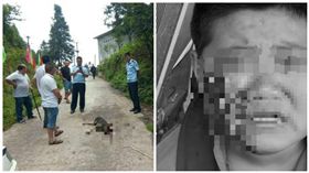 大陸一男童遭惡犬撕咬，臉頰幾乎被挖空（圖／翻攝自《網
易新聞）
http://news.163.com/18/0615/09/DKB4QBT90001875P.html
