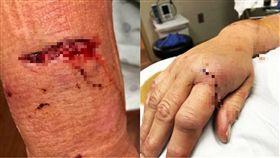 阿嬤,山貓,攻擊,狂犬病,孫女,拍照,美國,喬治亞州,習性,狩獵,美洲豹,守護 圖／翻攝自臉書　