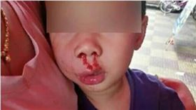 影／不慎撞到人　4歲男童遭「踢飛1公尺」昏迷　圖／翻攝自梨視頻