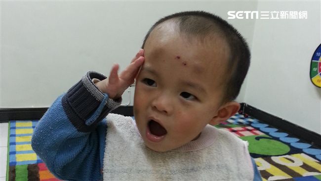 濕疹、血便好不了　國小生險割脾臟…