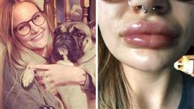 英國,豐唇,手術,流膿,整形,口愛,口交（圖／翻攝自網路）