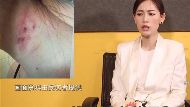 神反轉！馬蓉反咬王寶強偷吃又家暴