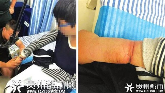 拿手銬銬自己1年　少年右手變小叮噹