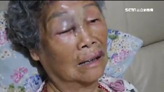 不滿被誣賴偷絲瓜　男闖屋痛毆7旬嬤