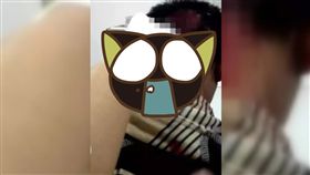 手機,行動電源,爆炸,後腦杓,床上,枕頭,溫度,過熱,手遊,急診,手術,湖北,武漢　圖／翻攝自微博