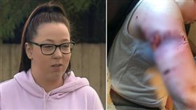 ▲惡犬咬傷（圖／翻攝自9news）