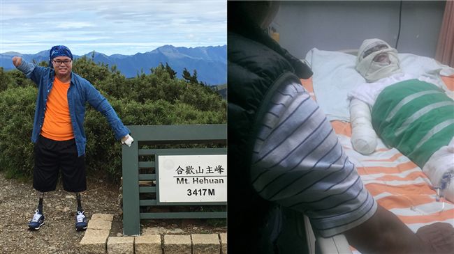 截肢也僅5%存活率 「但我想活」