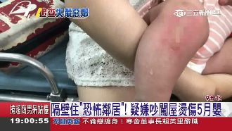 不滿哭聲太吵！惡鄰闖屋燙傷5月女嬰