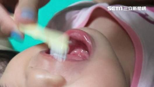 乳牙蛀了沒關係？爸媽你也錯很大嗎？