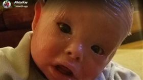 美國1歲童全身長滿堅硬魚鱗　泡漂白水才能活下去（圖／翻攝自GoFundMe官網）