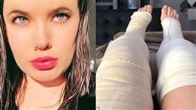 鴛鴦浴變調！澳女子與男友共浴竟爆炸　消防員：28年未見（圖／翻攝自Daily Mail）