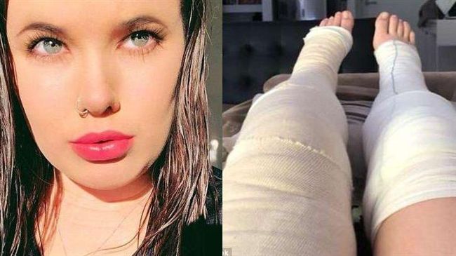 喵星人狂叫示警　澳女與男友共浴爆炸