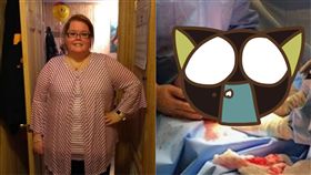 Kayla Rahn,卵巢囊腫,粘液性囊腺瘤,肥胖,減重,懷孕,Taco Bell,腫瘤,體重　圖／翻攝自推特　https://goo.gl/xETnkv