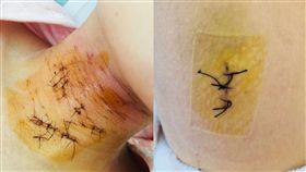 未成年被法律保障！少年刺人猥褻免責　被害者母怒：誰保護我女兒
圖翻攝自微博