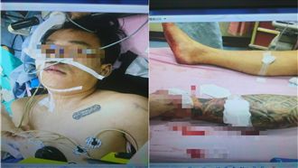 男遭鋁棍爆頭斷腳筋身亡　2嫌自首了