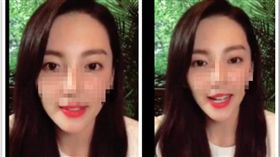 ▲張雨綺被網友質疑整形失敗。（圖／翻攝自微博）