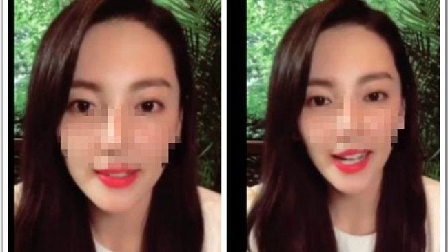 女星鼻子整過頭！玻尿酸要溢出來了