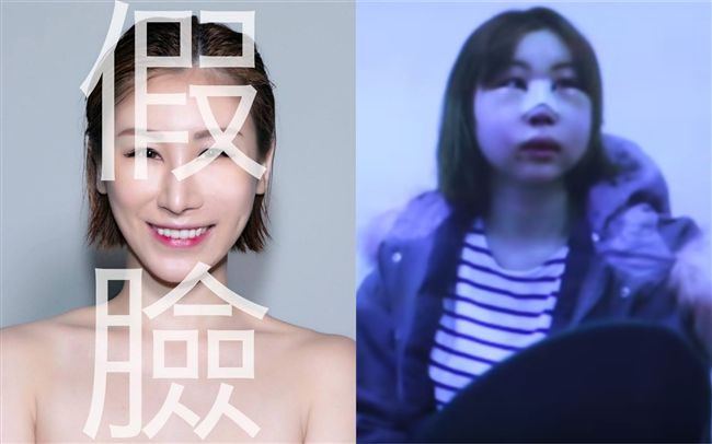 女星撞鋼椅毀容　赴韓整容竟腫如豬頭