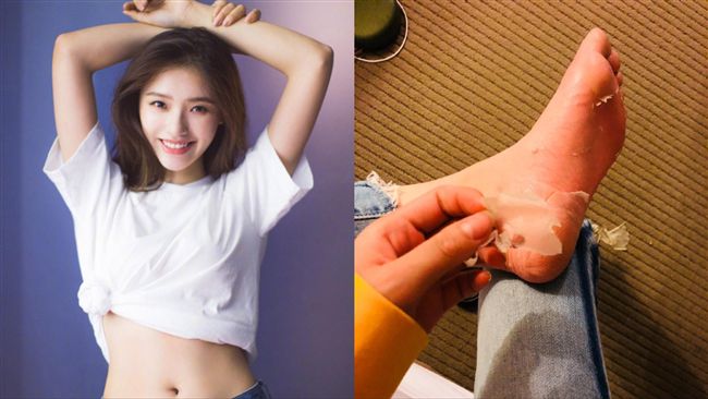 女星「撕腳皮」做自己！慘挨轟沒形象
