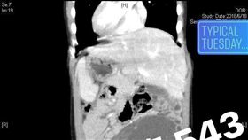 內臟反轉　圖／翻攝自來講兒科急診的543-吳昌騰醫師臉書