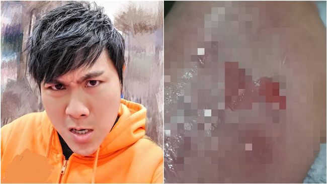 王仁甫玩到出意外　照片曝光嚇壞眾人