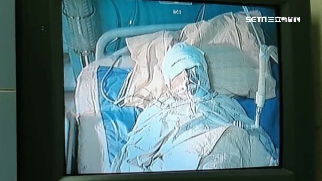 單親媽遭潑酸　12天仍插管老父淚崩