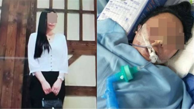 1天連做3項整形　愛美女6天後身亡