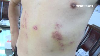 彰化登山客遭水鹿攻擊　頭破、肋骨斷