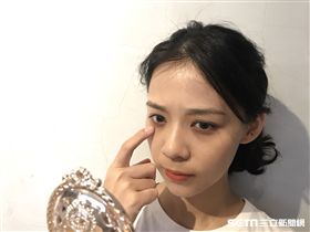 醫師顏宏融說，過敏性黑眼圈形成的原因，與眼周血液循環不良有關。（圖／公關照）
