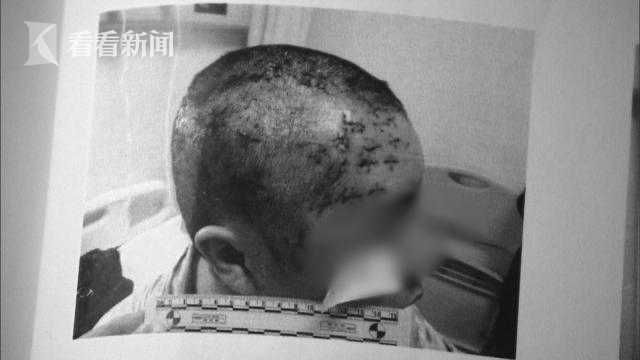 遭男友連捅60刀！癡情女清醒秒原諒