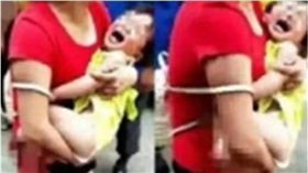 網瘋傳「小孩腿被狗咬掉」照片　警出面闢謠：車禍所致！　圖／翻攝自微博