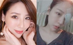 前「黑澀會美眉」MeiMei（郭婕祈），自曝因右眼視網膜剝離有失明危險，緊急住院開刀。圖／翻攝自IG