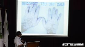   大林慈濟醫院日前舉辦過敏免疫風濕病友聯誼會，醫師賴寧生以「沉睡許久的白斑」為題進行衛教講座。（圖／大林慈濟醫院提供）