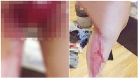 中國北京一名按摩妹流血（圖／翻攝自微博