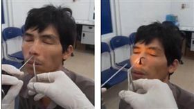 越南乂安省一名男子日前發覺自己呼吸困難，鼻孔還出現一種「被舔穴道」的感覺，相當不舒服。男子就醫檢查後，醫師竟從他鼻孔拉出一條活生生的水蛭！（圖／翻攝自每日郵報）