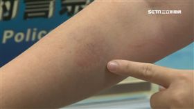 抗議拆屋！女議員蔣月惠竟咬女警手臂
SOT
屏東,議員,蔣月惠,公勇路,拓寬工程,咬,女警