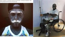 俄羅斯一名男子亞當（Adam Curlykale）非常熱愛刺青，他想在身上每個角落都刺滿藝術，後來他認為生殖器妨礙美感，於是決定自宮「剁掉GG」。對此，動刀的醫師表示「他安全、開心就好」。（圖／翻攝自太陽報）