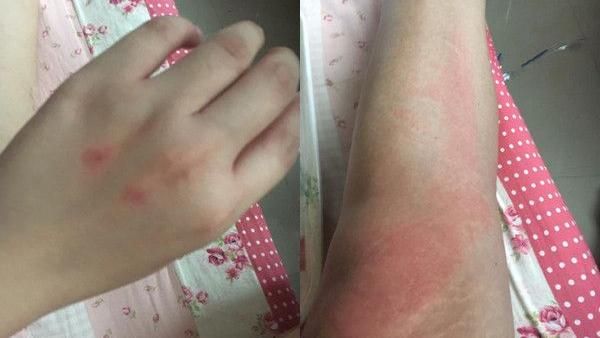 坐博愛座遭辱扯髮　女驗傷：該提告？
