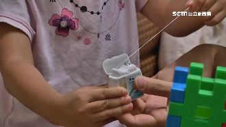 兄妹玩耍「牙線纏頸」　母急扯反越緊