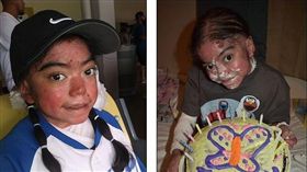 美國「泡泡龍」女孩，積極面對罕見疾病。（圖／翻攝自每日郵報）