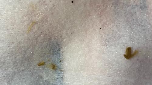 連續2張！知名大廠濕紙巾驚見蟑螂屍