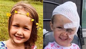 英國,惡犬,攻擊,失明,生活圈,侵犯,狗,女童,Tillie,Halle Wilson, 圖／翻攝自推特　