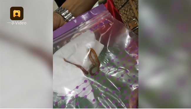 刷牙吐活蟲！肚裡藏「一公一母」狂生